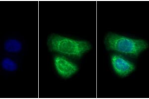 Detection of CK7 in Human HepG2 cell using Polyclonal Antibody to Cytokeratin 7 (CK7) (Cytokeratin 7 antibody  (AA 91-394))