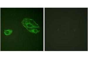 Immunofluorescence analysis of A549 cells, using HER3 (Ab-1289) Antibody. (ERBB3 antibody  (AA 1256-1305))