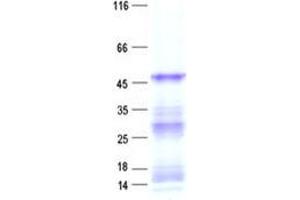 Validation with Western Blot (CPA6 Protein (His tag))