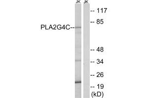 Western blot analysis of extracts from Jurkat cells, using PLA2G4C antibody. (PLA2G4C antibody  (Internal Region))