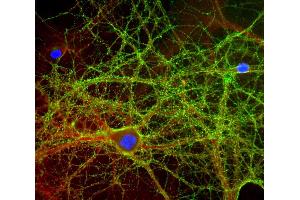 Mixed neuron-glial cultures stained with ABIN1580420 (green) and rabbit antibody to alpha-II spectrin (red), and DNA (blue).