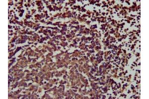 IHC image of ABIN7169782 diluted at 1:200 and staining in paraffin-embedded human lymph node tissue performed on a Leica BondTM system. (SLAMF6 antibody  (AA 248-331))