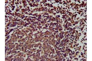 IHC image of ABIN7169782 diluted at 1:200 and staining in paraffin-embedded human lymph node tissue performed on a Leica BondTM system.