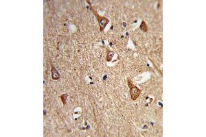 Formalin-fixed and paraffin-embedded human brain tissue reacted with CPLX1 Antibody (Center), which was peroxidase-conjugated to the secondary antibody, followed by DAB staining. (Complexin 1 antibody  (AA 33-60))