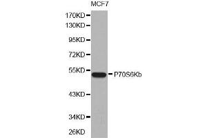 Western blot analysis of extracts of MCF7 cell line, using P70S6Kb antibody. (RPS6KB2 antibody  (AA 1-170))