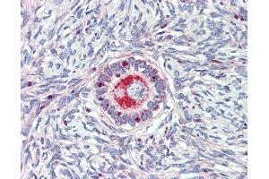 Anti-TM9SF1 antibody IHC of human ovary.