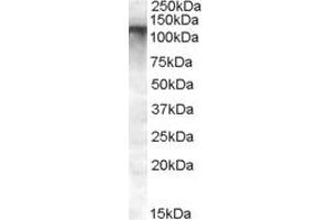 Western Blotting (WB) image for anti-Family with Sequence Similarity 91, Member A1 (FAM91A1) (N-Term) antibody (ABIN2791513) (FAM91A1 antibody  (N-Term))
