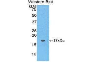 Western Blotting (WB) image for anti-S100 Protein (S100) (AA 1-94) antibody (ABIN1171951)