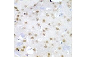 Immunohistochemistry of paraffin-embedded mouse brain using CDC27 antibody (ABIN3015756, ABIN3015757, ABIN1679113 and ABIN6219104) at dilution of 1:200 (40x lens). (CDC27 antibody  (AA 551-830))