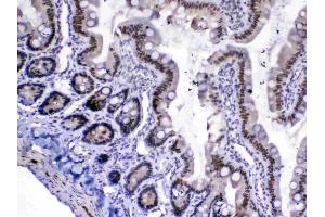 Immunohistochemistry (IHC) image for anti-Mediator Complex Subunit 18 (MED18) (AA 1-208) antibody (ABIN5519036)