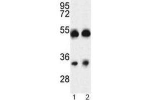 Western blot analysis of ORAI1 antibody and A375 cell line and mouse testis tissue lysate (ORAI1 antibody  (AA 145-173))