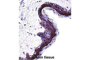 Immunohistochemistry (IHC) image for anti-Proteasome (Prosome, Macropain) Subunit, beta Type, 5 (PSMB5) antibody (ABIN2998050) (PSMB5 antibody)