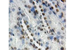 Used in DAB staining on fromalin fixed paraffin-embedded Kidney tissue (NOTCH2 antibody  (AA 2251-2466))