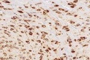 Immunohistochemistry analysis of paraffin-embedded rat brain using,RPL10 (ABIN7075428) at dilution of 1: 4000