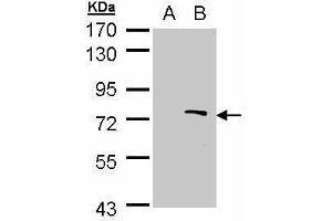 WB Image Western Blot analysis of ZMYND11 expression in transfected 293T cell line by ZMYND11 polyclonal antibody.