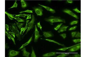Immunofluorescence of monoclonal antibody to EPB41L3 on HeLa cell. (EPB41L3 antibody  (AA 915-1007))
