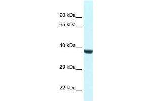 WB Suggested Anti-Wdr45l Antibody   Titration: 1. (WD Repeat Domain 45B (WDR45B) (N-Term) antibody)