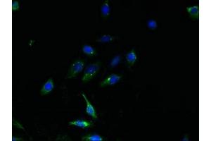 Immunofluorescent analysis of HepG2 cells using ABIN7164800 at dilution of 1:100 and Alexa Fluor 488-congugated AffiniPure Goat Anti-Rabbit IgG(H+L) (TMEM159 antibody  (AA 1-54))