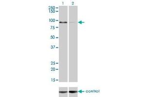 Western blot analysis of ZW10 over-expressed 293 cell line, cotransfected with ZW10 Validated Chimera RNAi (Lane 2) or non-transfected control (Lane 1). (ZW10 antibody  (AA 1-100))