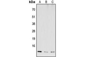 Western blot analysis of COX6B2 expression in HEK293T (A), NS-1 (B), H9C2 (C) whole cell lysates. (COX6B2 antibody  (Center))