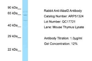 Western Blotting (WB) image for anti-WAS Protein Family, Member 2 (WASF2) (Middle Region) antibody (ABIN971997) (WASF2 antibody  (Middle Region))