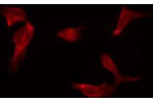 ABIN6267230 staining HepG2 by IF/ICC. (IKK-alpha /IKK-beta antibody  (pSer180, pSer181))