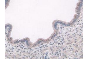 IHC-P analysis of Mouse Uterus Tissue, with DAB staining. (ADAMTS7 antibody  (AA 226-437))