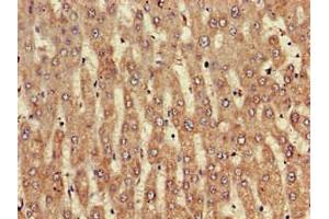 Immunohistochemistry of paraffin-embedded human liver tissue using ABIN7161610 at dilution of 1:100 (NINJ1 antibody  (AA 1-80))