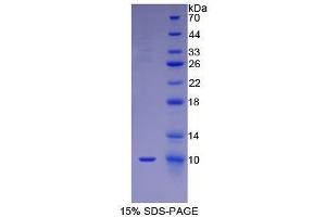 SDS-PAGE (SDS) image for Fibroblast Growth Factor 3 (FGF3) (AA 154-232) protein (His tag,GST tag) (ABIN1099070)
