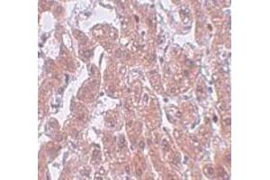 Immunohistochemistry (IHC) image for anti-Family with Sequence Similarity 59, Member A (FAM59A) (C-Term) antibody (ABIN1030387) (FAM59A antibody  (C-Term))