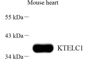 Western blot analysis of KTELC1 (ABIN7075265) at dilution of 1: 500 (POGLUT1 antibody)