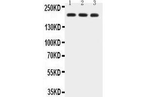 Anti-BRCA1 Picoband antibody,  All lanes: Anti-BRCA1 at 0. (BRCA1 antibody  (AA 1661-1863))