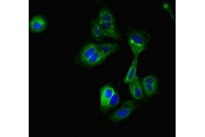 Immunofluorescent analysis of Hela cells using ABIN7149055 at dilution of 1:100 and Alexa Fluor 488-congugated AffiniPure Goat Anti-Rabbit IgG(H+L) (CRIP2 antibody  (AA 1-208))