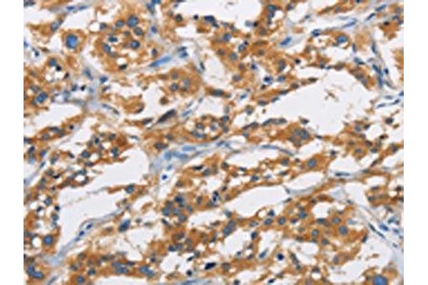 SAR1B antibody