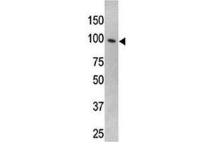TLR5 antibody used in western blot to detect TLR5 in HL-60 cell lysate (TLR5 antibody  (AA 71-102))