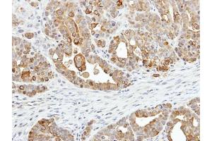 IHC-P Image Immunohistochemical analysis of paraffin-embedded NCI-N87 xenograft, using ZER1, antibody at 1:500 dilution. (ZER1 antibody  (C-Term))