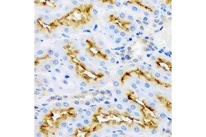 Immunohistochemical analysis of Aminoacylase 1 staining in rat kidney formalin fixed paraffin embedded tissue section. (Aminoacylase 1 antibody)