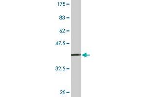 Western Blot detection against Immunogen (37. (SUPT5H antibody  (AA 981-1087))