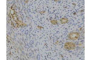 ABIN6277527 at 1/100 staining Human uterus tissue by IHC-P. (C1QB antibody  (Internal Region))