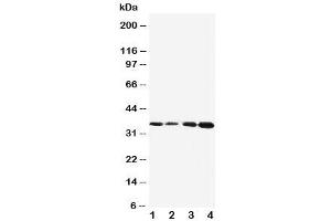 Western blot testing of Protein C antibody and Lane 1:  Jurkat (PROC antibody  (AA 446-461))