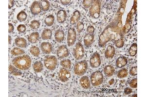 Immunoperoxidase of purified MaxPab antibody to UGT1A9 on formalin-fixed paraffin-embedded human small Intestine. (UGT1A9 antibody  (AA 1-530))