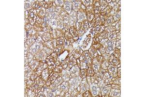 Immunohistochemistry of paraffin-embedded mouse liver using HDLBP antibody (ABIN6128051, ABIN6141701, ABIN6141702 and ABIN6221672) at dilution of 1:100 (40x lens). (HDLBP antibody  (AA 1035-1268))