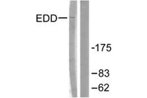 Western blot analysis of extracts from A549 cells, using EDD Antibody. (UBR5 antibody  (AA 1-50))