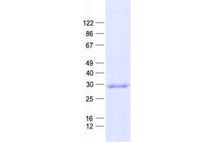 CCNB1IP1 Protein (His tag)