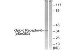 Western blot analysis of extracts from 293 cells treated with TSA 400nM 24h, using Opioid Receptor-delta (Phospho-Ser363) Antibody. (OPRD1 antibody  (pSer363))