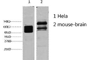 Western blot analysis of 1) Hela, 2) mouse brain, diluted at 1:4000. (KRT8 antibody)