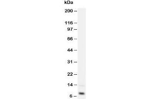 Western blot testing of IGF-1 antibody and recombinant human protein 2. (IGF1 antibody  (Middle Region))