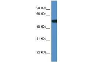 Image no. 1 for anti-Tigger Transposable Element Derived 4 (TIGD4) (AA 110-159) antibody (ABIN6746364)