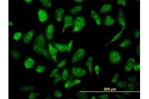 Image no. 3 for anti-Nuclear Receptor Coactivator 4 (NCOA4) (AA 505-615) antibody (ABIN599026) (NCOA4 antibody  (AA 505-615))