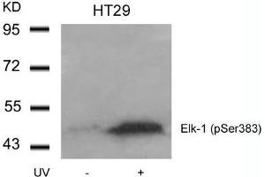 Western blot analysis of extracts from HT29 cells untreated or treated with UV using Elk-1(Phospho-Ser383) Antibody. (ELK1 antibody  (pSer383))